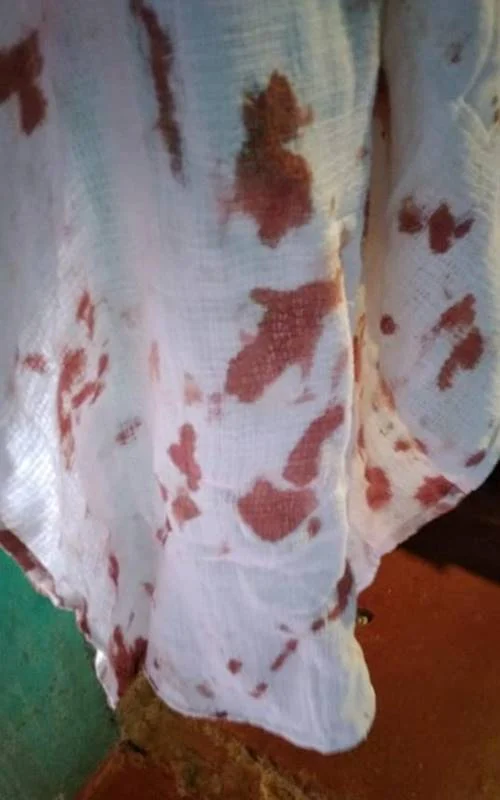 Sangue em pano