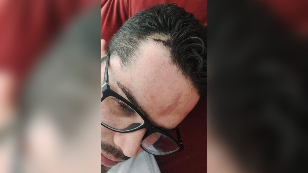 Eleitor de Bolsonaro é agredido com enxada por petista em Londrina 2 pontos