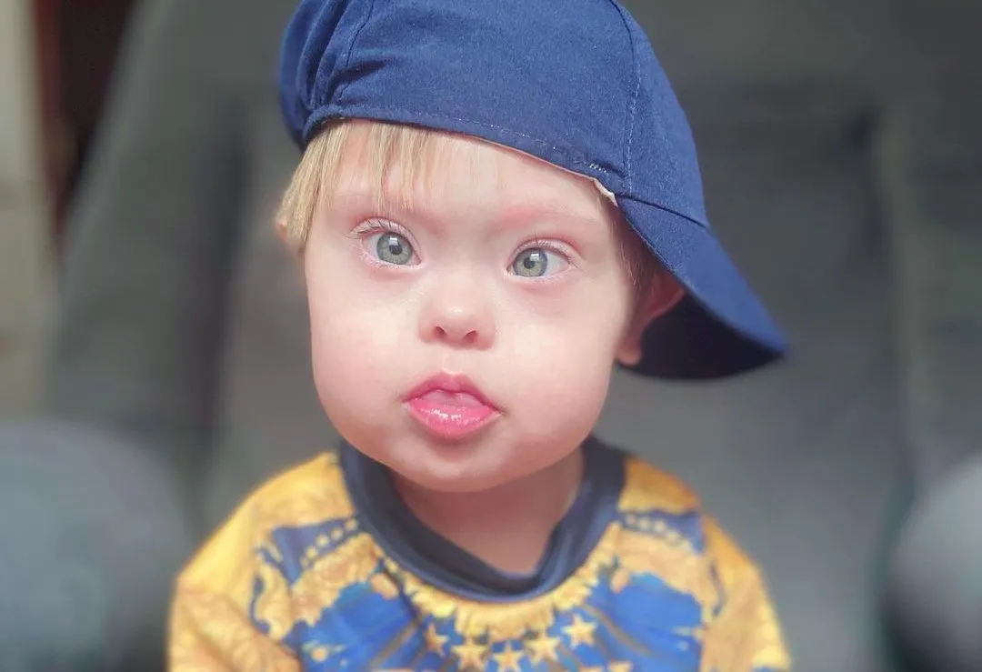 Morre Super Chico, menino com síndrome de Down que sobreviveu à Covid duas vezes 2 318351720 182677941020305 3512166346070235746 n e1675700498925